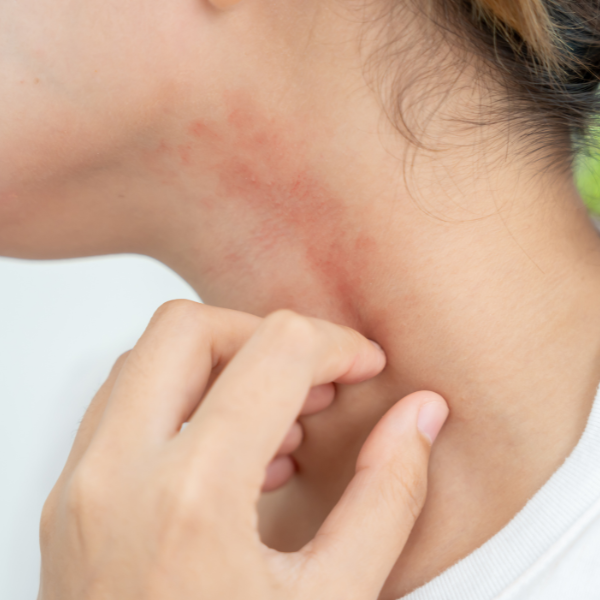 Leniplus crema corpo con ingredienti naturali per pelle sensibile e irritata