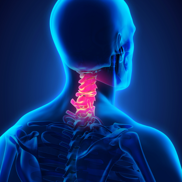 dolore cervicale cause e rimedi